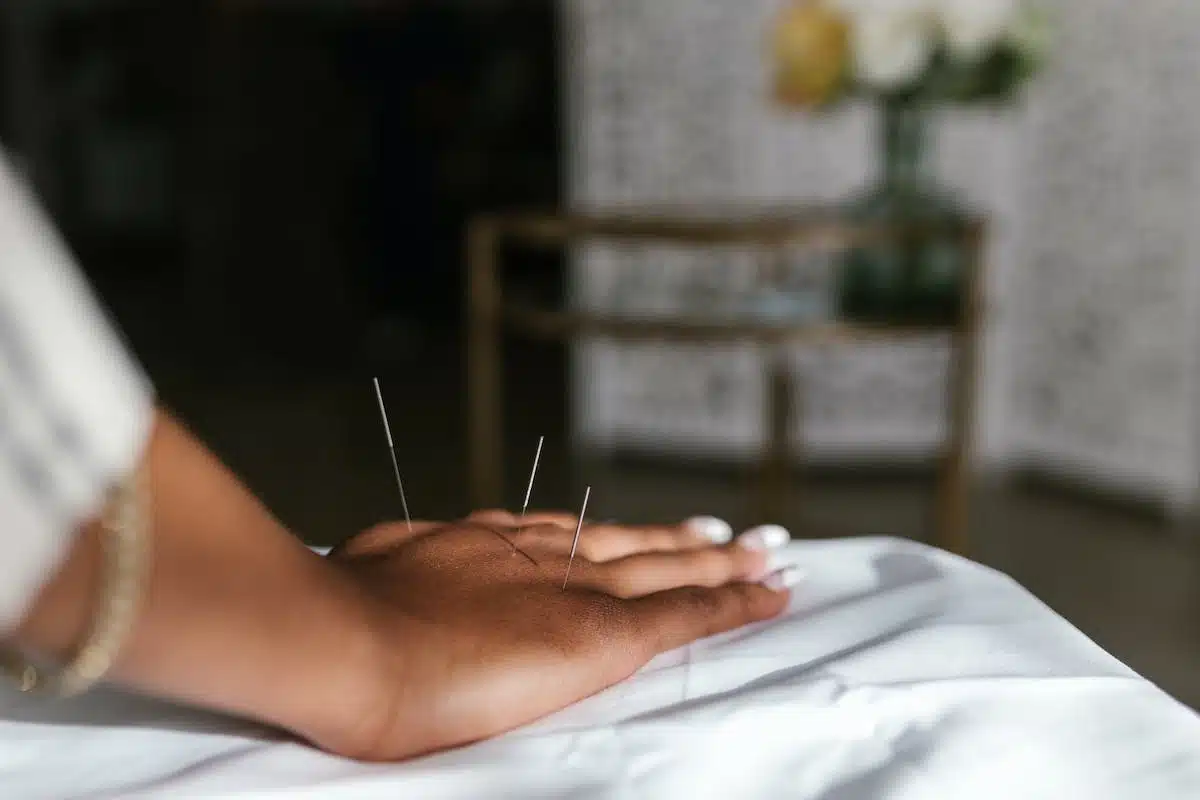 méditation  acupuncture